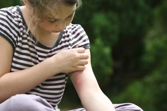 girl-scratching-arm-photo