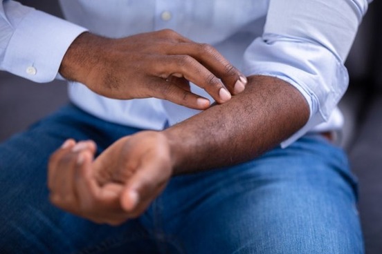 man-scratching-arm-photo