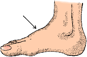 Illustration of instep